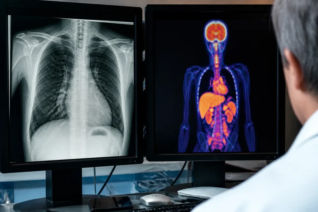 Deux ecrans affichant donnees medicales disparates et incompatibles